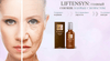 Liftensyn